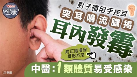 耳洞分泌物結塊|耳道流膿：症狀、病因及如何治療